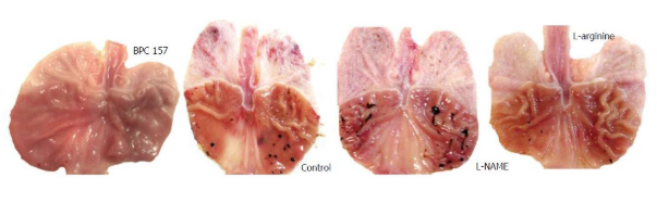 Lesões gástricas induzidas por celecoxibe (preto) em ratos tratados com BPC-157, solução salina (controle), L-NAME e L-arginina.