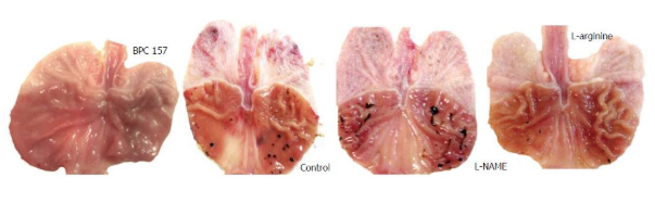 Celecoxib-induced gastric lesions (black) in rats treated with BPC-157, saline (control), L-NAME, and L-arginine.