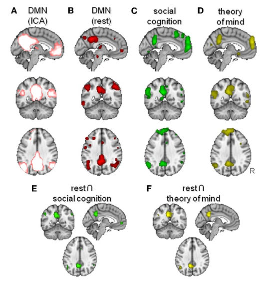 Image showing the overlap of activation between the resting mode network and parts of the brain responsible social cognition.